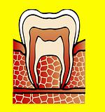 symptoms dental cavity vector illustration