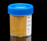 urine test specimen