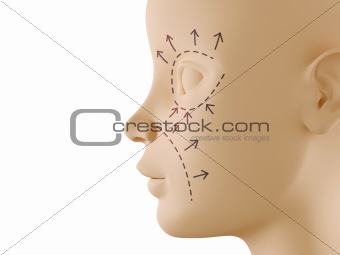 Neutral face profile with aesthetic surgery sign