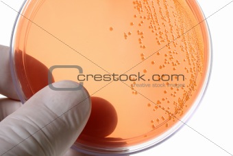 Petri dishes for medical research