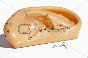 acupuncture needle for ear