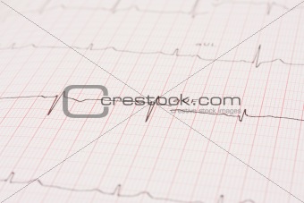 Detail of an electrocardiogram 