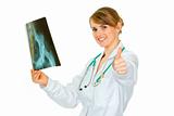 Pleased medical doctor woman holding pelvis roentgen and showing thumbs up gesture
