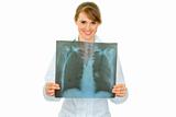 Smiling medical doctor woman holding results of thorax roentgen in hands
