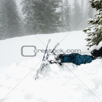 Ski accident.