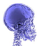 magnetic resonance (MR) 3d blue skull