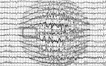 Brain wave encephalogramme EEG isolated on white background
