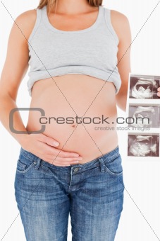 Young pregnant woman showing an ultrasound scan while standing