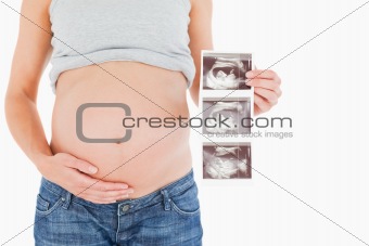 Pregnant woman showing an ultrasound scan while standing