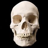 Human skull.