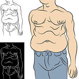 Man With Abdominal Fat