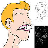 Man With Overbite
