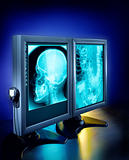 X-ray view on screens