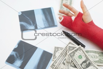 Bandaged Arm, X-Rays, Money And Pen