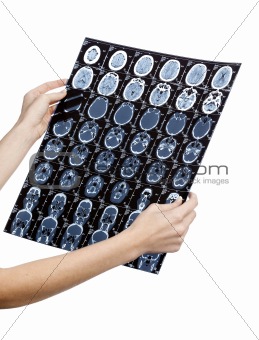Doctor's hands with mri of human head