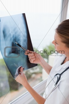 Doctor holding x-ray against window