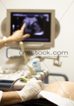 medical examining by ultrasonic scan