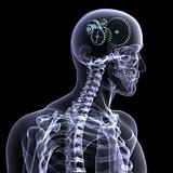 Skeleton X-Ray - Wheels a Turning