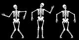 Dancing skeletons
