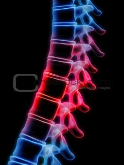 x-ray spine