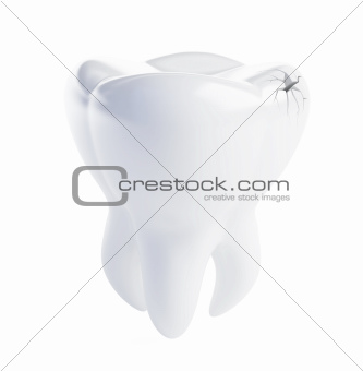 tooth crack