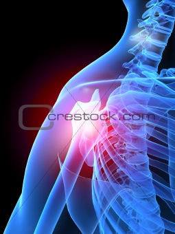pain in shoulder