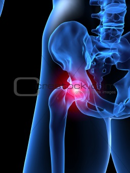 pain in hip
