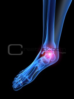 pain in ankle