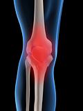 pain in knee