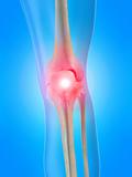 pain in knee