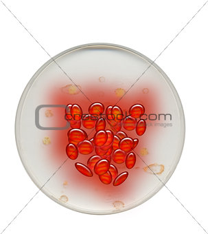 Bubbles, Eggs or Cells in Petri Dish