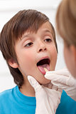 Boy showing her throat to health professional