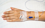 Medical intravenous cannula on hand
