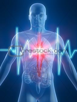 heartbeat/heartattack