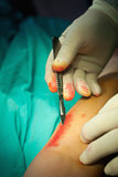 Close up of a hand using a scalpel to cut the skin of a patient