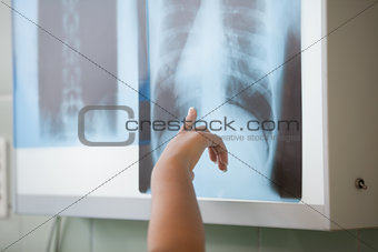Close up of people showing a X-ray