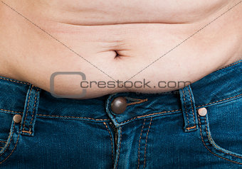 Woman pinching fat from her abdomen