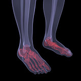 X-ray of human legs