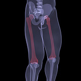 X-ray of human legs