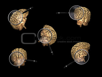 Rotating Brains with Magnifiers