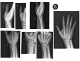Real X-rays of the Hand and wrist 