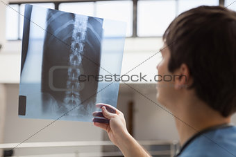 Nurse examining x-ray