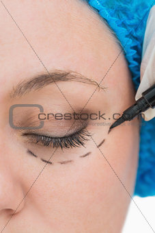 Doctor drawing around eye