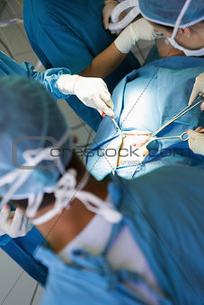 Surgeon performing an operation on a stomach