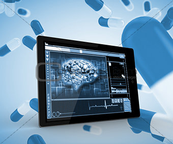 Brain on a digital tablet