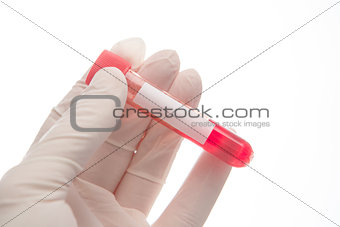 Hand in glove holding vial of blood