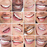 Collage of bright white smiles