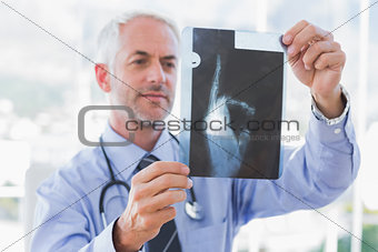 Doctor holding an x-ray