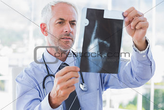 Handsome doctor examining an x-ray