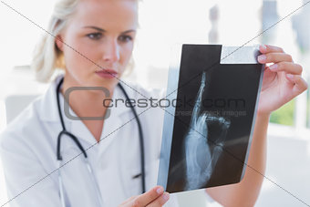 Serious nurse holding an x-ray